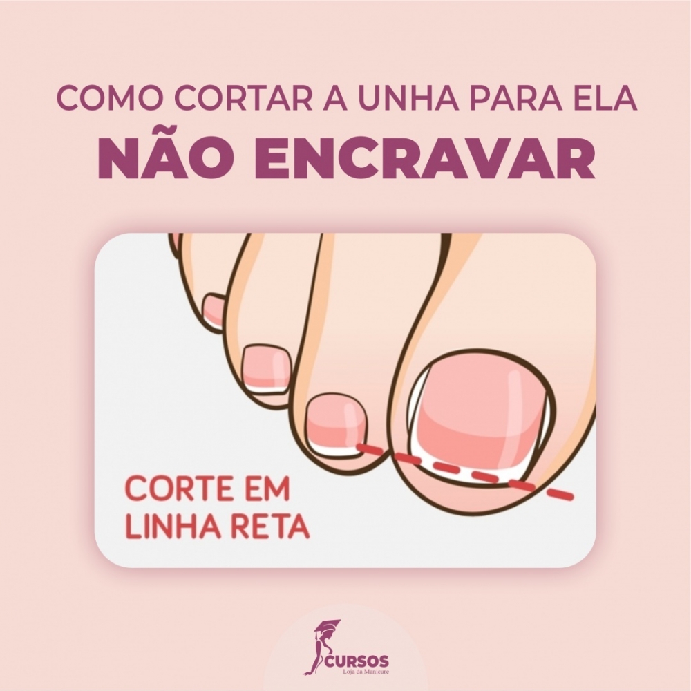 Aprenda como cortar a unha para não encravar